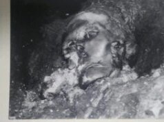 Cirujanos de la Edad del Hierro repararon la mandíbula destrozada de una mujer con una prótesis primitiva y ella sobrevivió